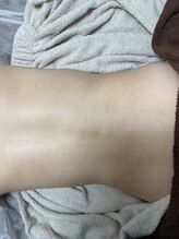 カルム(calm.)/背中シュガーリング後