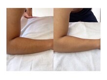 サロン ド スカイ(Salon de sky)/男性・腕