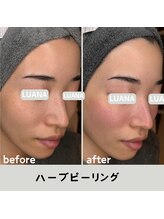 ルアナ 北谷店/ハーブピーリング 《沖縄/北谷》