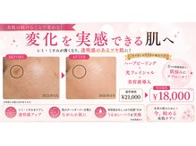 ベルエクラ(Bel Eclat)