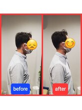 あーる整体院/姿勢矯正　before　after