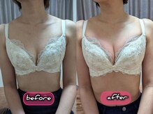 スノードロップ(snowdrop)/バストアップ　１回での変化