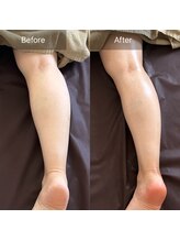 ヌーアンドコードット バイ リンパシー(Nu & Co. by Lymphthy)/美脚が止まらない！