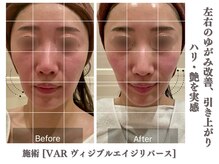 ギノーアンスティテュ パリ 六本木ヒルズ店(GUINOT INSTITUT PARIS)の雰囲気（たった30分で効果を表す大人気！【ヴィジブル エイジ リバース】）