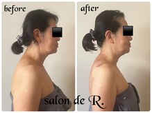 サロン ド アール(salon de R.)の雰囲気（日々の積み重ねがお悩みに‥骨から立て直す美容で”変われます”）