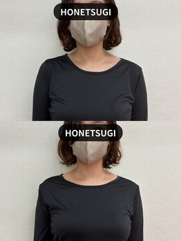 ほねつぎ市川はりきゅう接骨院/クー(kuu)/【猫背矯正】 before after