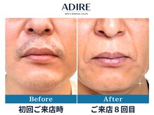 アディール(adire)