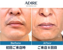 アディール(adire)