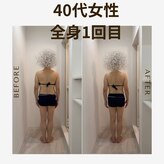 エステラー(ESTELLER)