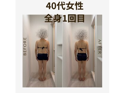 エステラー(ESTELLER)の写真