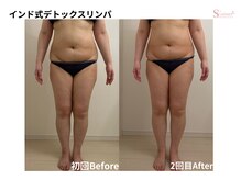 セメ(S'aimer)の雰囲気（体質を整えながら、ダイエット☆）