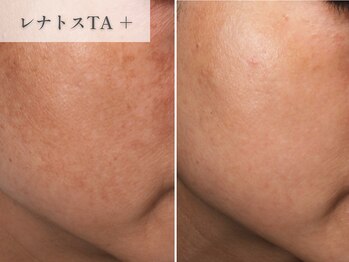 南青山コスメクリニック スキンラボ 新宿(SKIN LAB)/レナトス