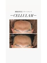 リバイセリー(Revicelly)/比較写真