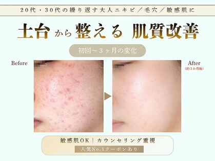 メレ(mele)の写真
