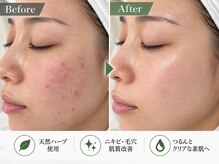 ライム 錦糸町(LIME)の雰囲気（繰り返し悩んできた悩みを一緒に解決してみませか？【錦糸町】）