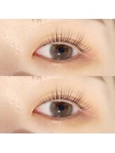 セラス 竹ノ塚(selas)/フラットラッシュ