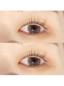 セラス 竹ノ塚(selas)/フラットラッシュ