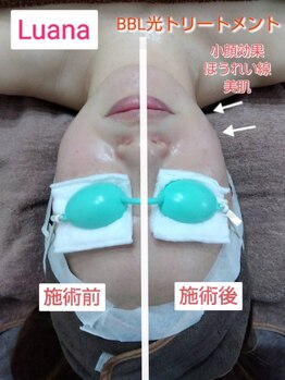 ルアナ(Luana)/お肌のお悩みまとめて解決！