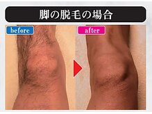 マンモス 赤羽店の雰囲気（施術歴の長いスタッフが確かな技術を提供☆会話も楽しさ重視！）