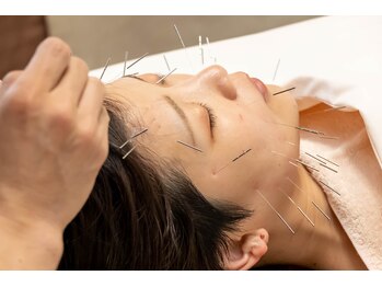 あかり鍼灸接骨院/SNSで話題！人気の美容鍼