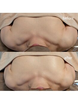 アンドボディ 横浜元町(&Body)/40代後半 バストアップ