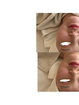 サロン ド ビビ(salon de bibi*)/一度の効果です