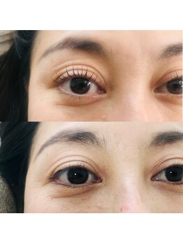 ミリー(Meliy)/LASH LIFT