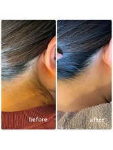 バービーヒルズ/人気☆うなじワックス