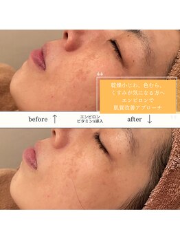 カオヤ プラス(Kaoya plus)/エンビロン無料カウンセリング◎