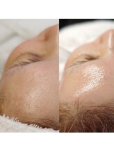 アミーサロン(amy salon)/ 【FACIAL WAX】