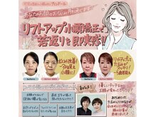 プランドールの雰囲気（若見えとお悩み改善が叶う☆リフトアップ小顔矯正です♪）