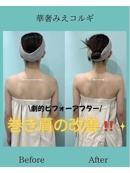 アコガレコガオ 鳥取店/コルギのビフォーアフター