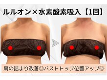 ヨサパーク ラ ぺ(YOSAPARK La paix)/水素の力で年齢に立ち向かう！