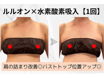 ヨサパーク ラ ぺ(YOSAPARK La paix)/水素の力で年齢に立ち向かう！