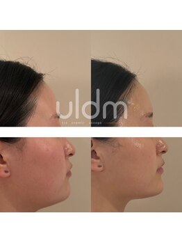 ルアンジュ(Le Ange)/