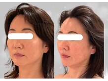 ソナ 大和西大寺院(SONA)/