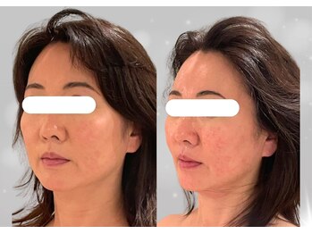 ソナ 大和西大寺院(SONA)/