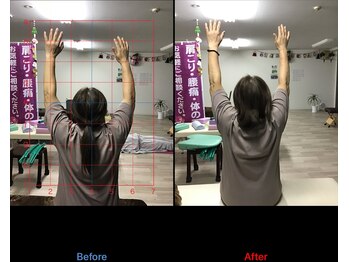 ストレチックス 近江八幡店/姿勢改善ビフォーアフター1回