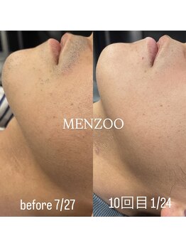 メンズー(MENZOO)/
