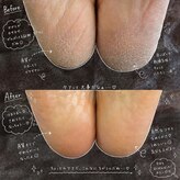 ダイヤモンドボディ