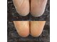 ダイヤモンドボディの写真