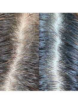 シュール センター南(SURREAL)/ヘッドスパ後のビフォーアフター