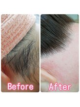 ベイジョ デ アンジョ(Beijo de anjo)/うなじシュガーリング