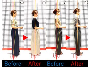 池袋東鍼灸整骨院