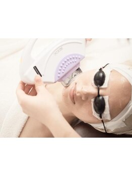 顔脱毛がしたい