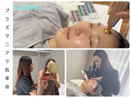 リアスキン(Lia skin)の写真