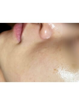 お肌をきれいにしたい