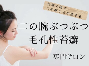 ホウビ(HOUBIE)の写真/【初回限定】長年悩む二の腕ブツブツをキレイに/毛孔性苔癬改善プログラム体験（敏感肌）26600→20000yen