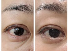 ラウレア(Laule'a)の雰囲気（コラーゲンを50%も即自己細胞生成するから必ず効果と結果が出る）