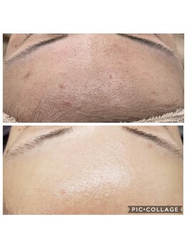 ビラ ベルダ(Bira Beldad)/